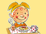 allergie.jpg (15872 byte)